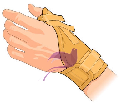 Gibaud Ortho Ortesi Sostegno Rizartrosi Taglia 1