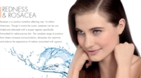 Avene Linea Antirougeurs Dermo Detergente Fluido Pelli Sensibili 300 ml